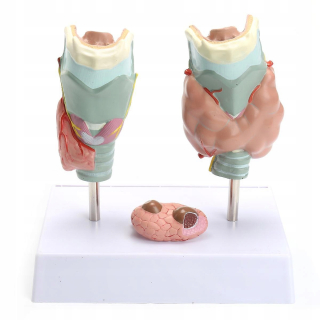 Anatomická anatomická patológia štítnej žľazy