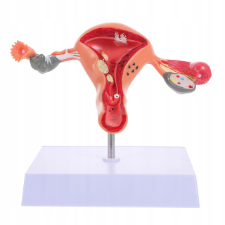 PVC Anatomický model maternice pre ženy